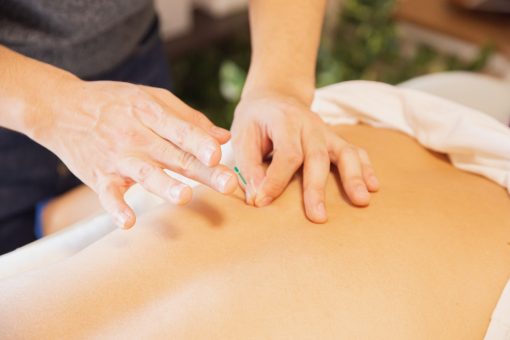 Comment ouvrir un cabinet d'acupuncture ? Tous les détails ici