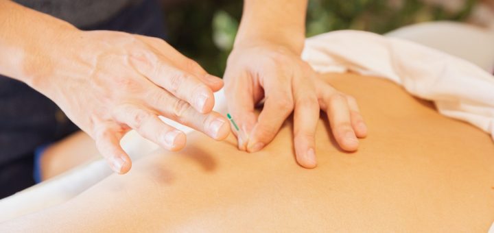 Comment ouvrir un cabinet d'acupuncture ? Tous les détails ici